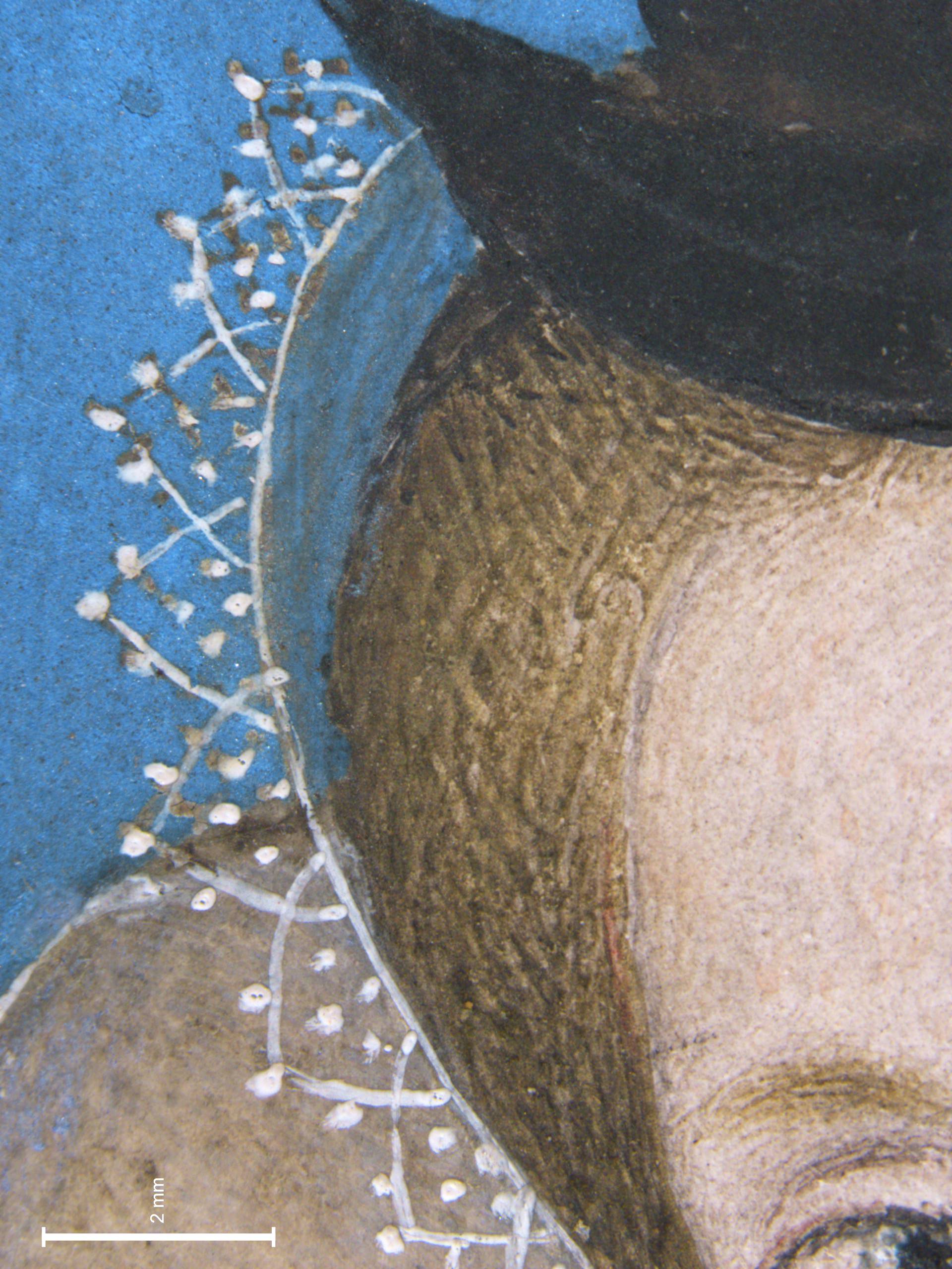 Unknown Lady (photomicrograph)