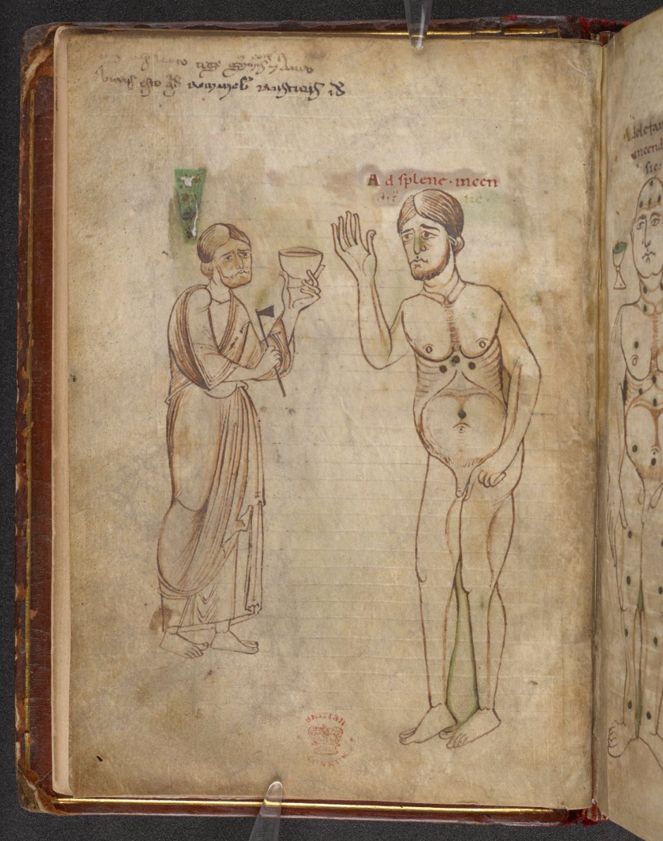 depicting bloodletting points, ca. 1100, England, ink on parchment, 18.5 x 13 cm. Collection of The British Library, London. 