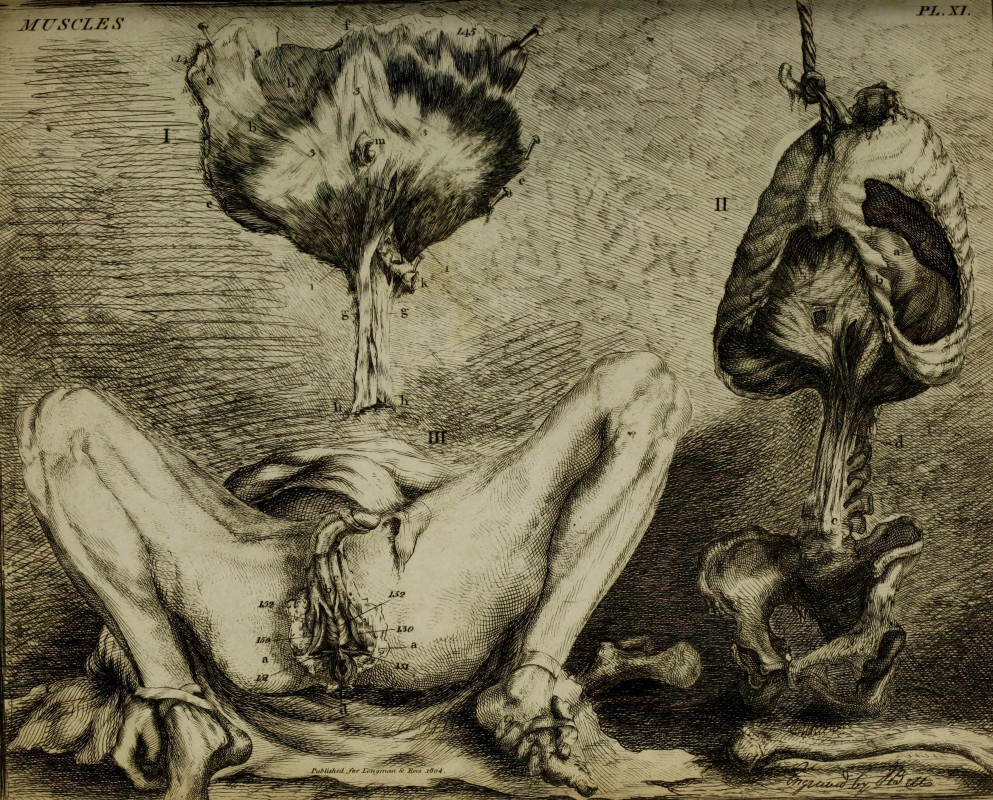 (London: Printed for Longman and Rees, 1804), Plate 11, 1804, etching. Wellcome Collection.