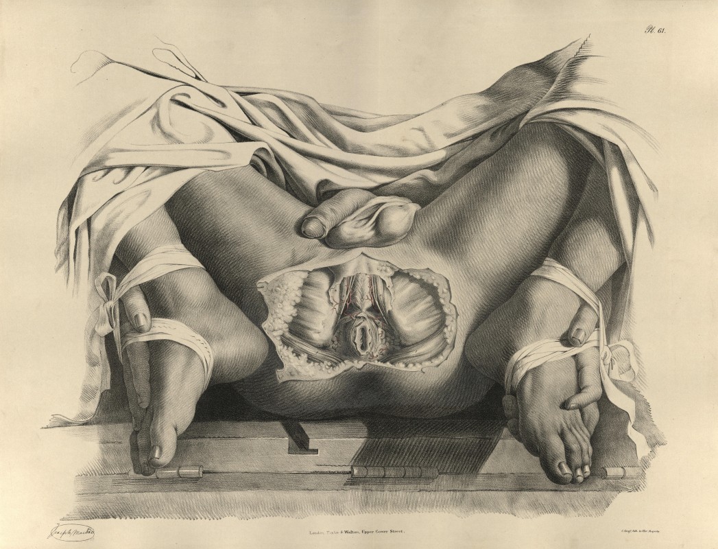 from Richard Quain, <i>The Anatomy of the Arteries of the Human Body</i> (London: Taylor & Walton, 1841–1844), Plate 61, circa 1841–1844, coloured lithograph, 67.5 × 55 cm. Collection of Hagströmer Library.