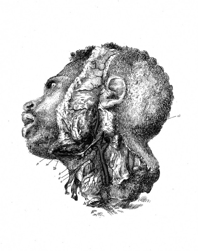 Engravings of the Arteries, Illustrating the Second Volume of The Anatomy of the Human Body, and Serving as an introduction to The Surgery of the Arteries