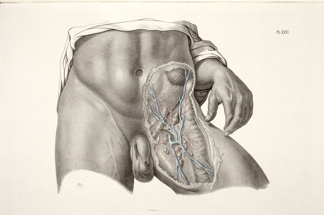 The Surgical Dissection of the Superficial and Deep Structures of the Inguino-Femoral Region